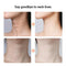 Digital Massager For Face And Neck